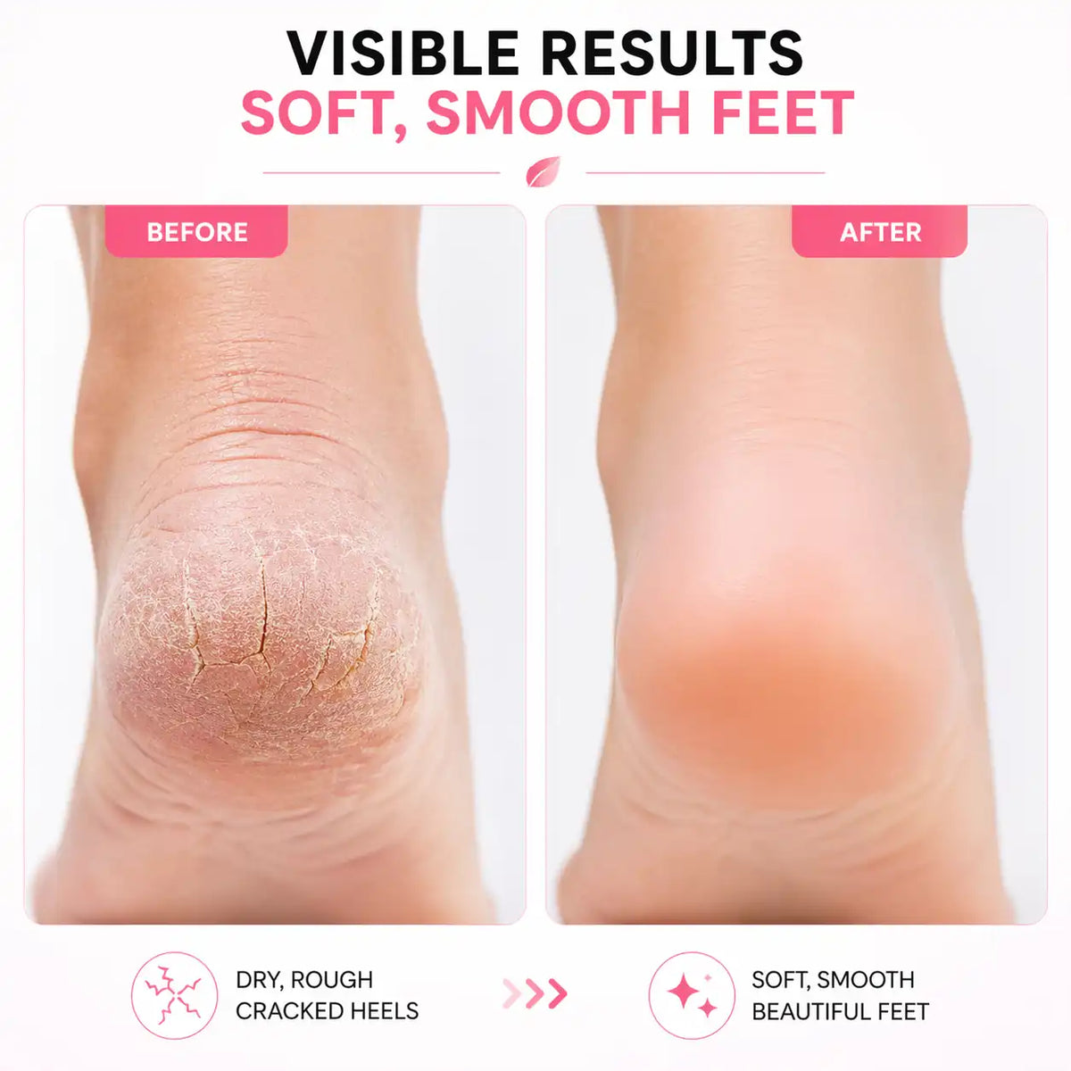 Self-Care Beauty Bundle – Face Massager + Foot Callus Remover