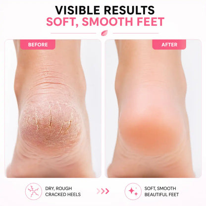Glamera Electric Foot File Callus Remover